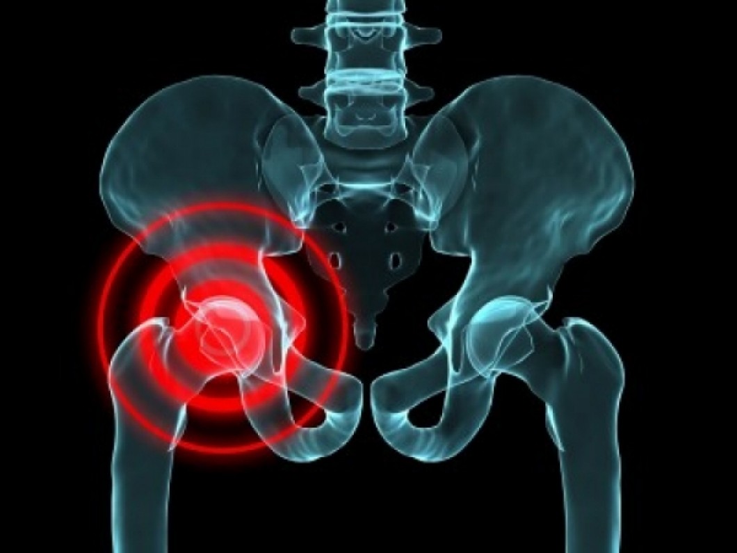 pain in hip but xray normal